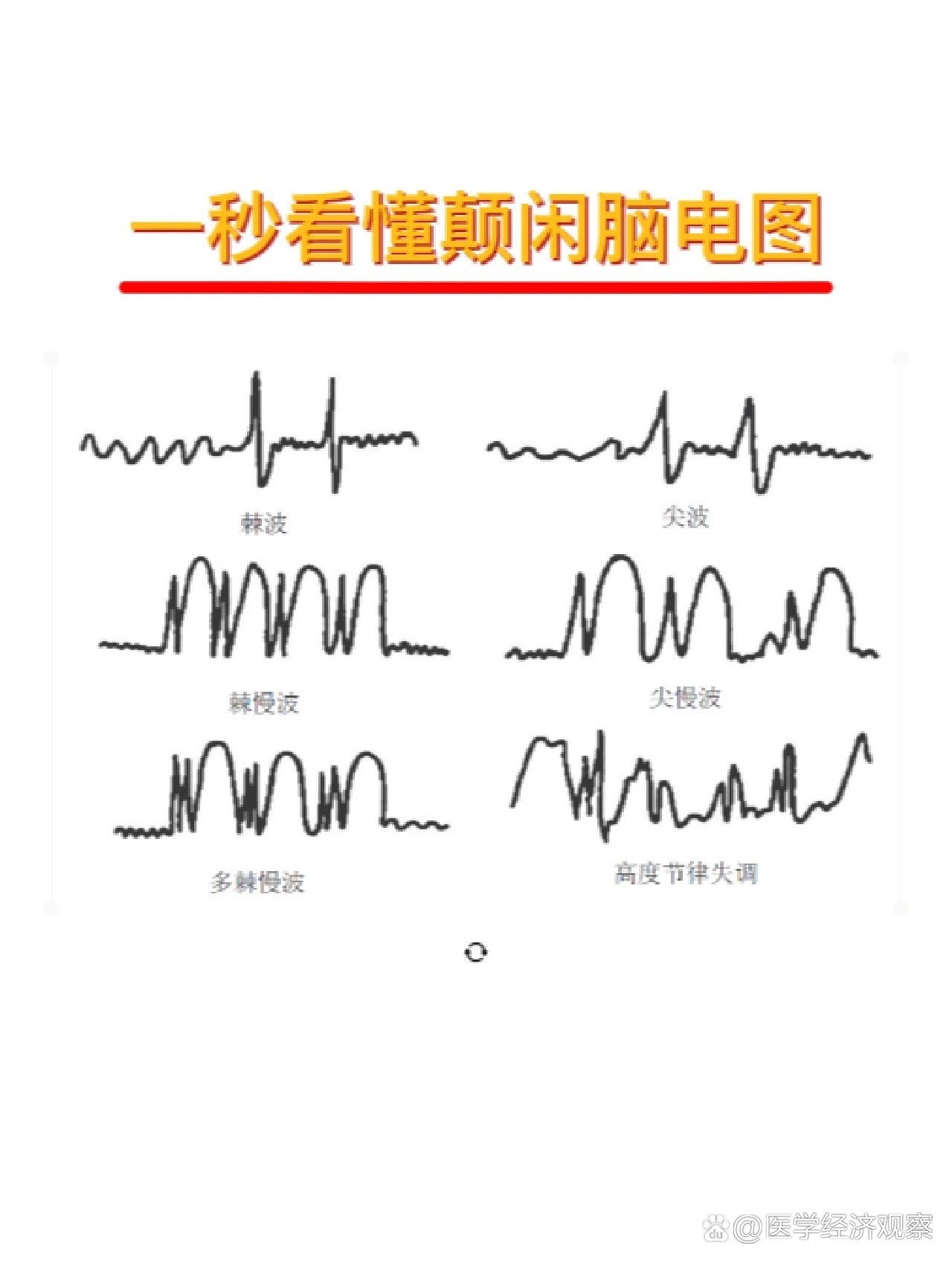 教癫痫患者一秒看懂自己的脑电图