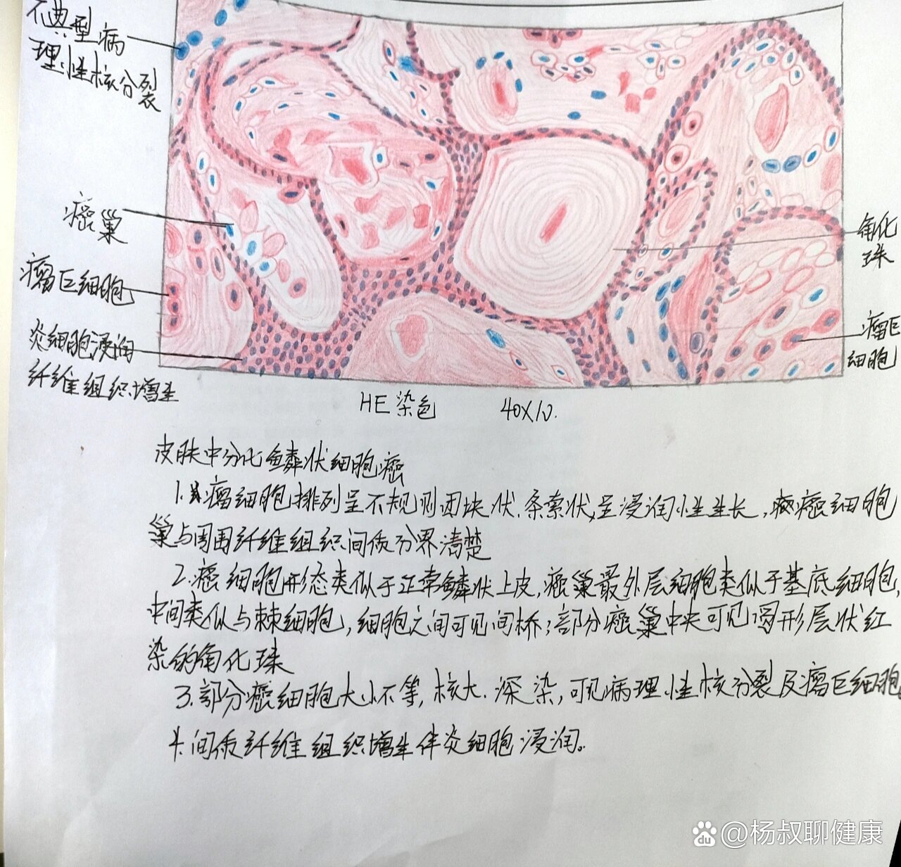 人体皮肤纵切片图解图片