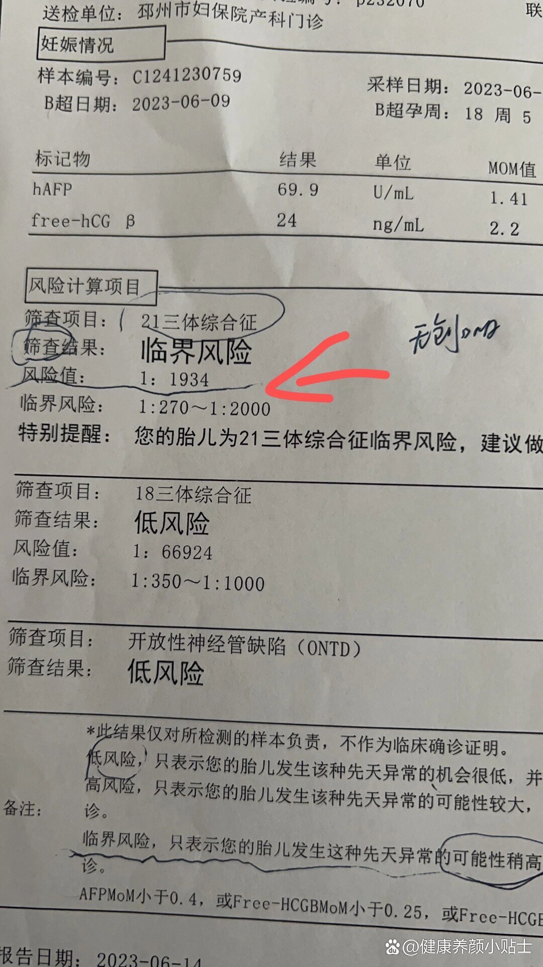 唐筛显示21三体综合征是临界风险很担心,所以下午做了无创医生说10天