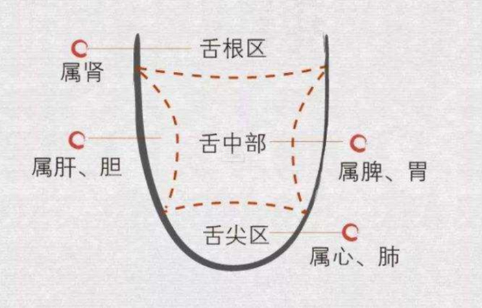六个中医常见舌苔图,帮你快速分辨体质