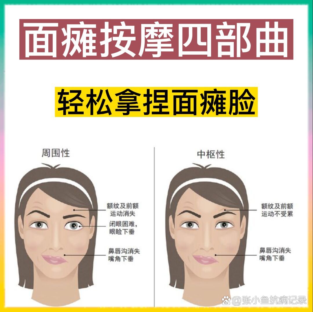面瘫最怕这四个动作 早晚按摩一下告别面瘫面瘫不是什么大病