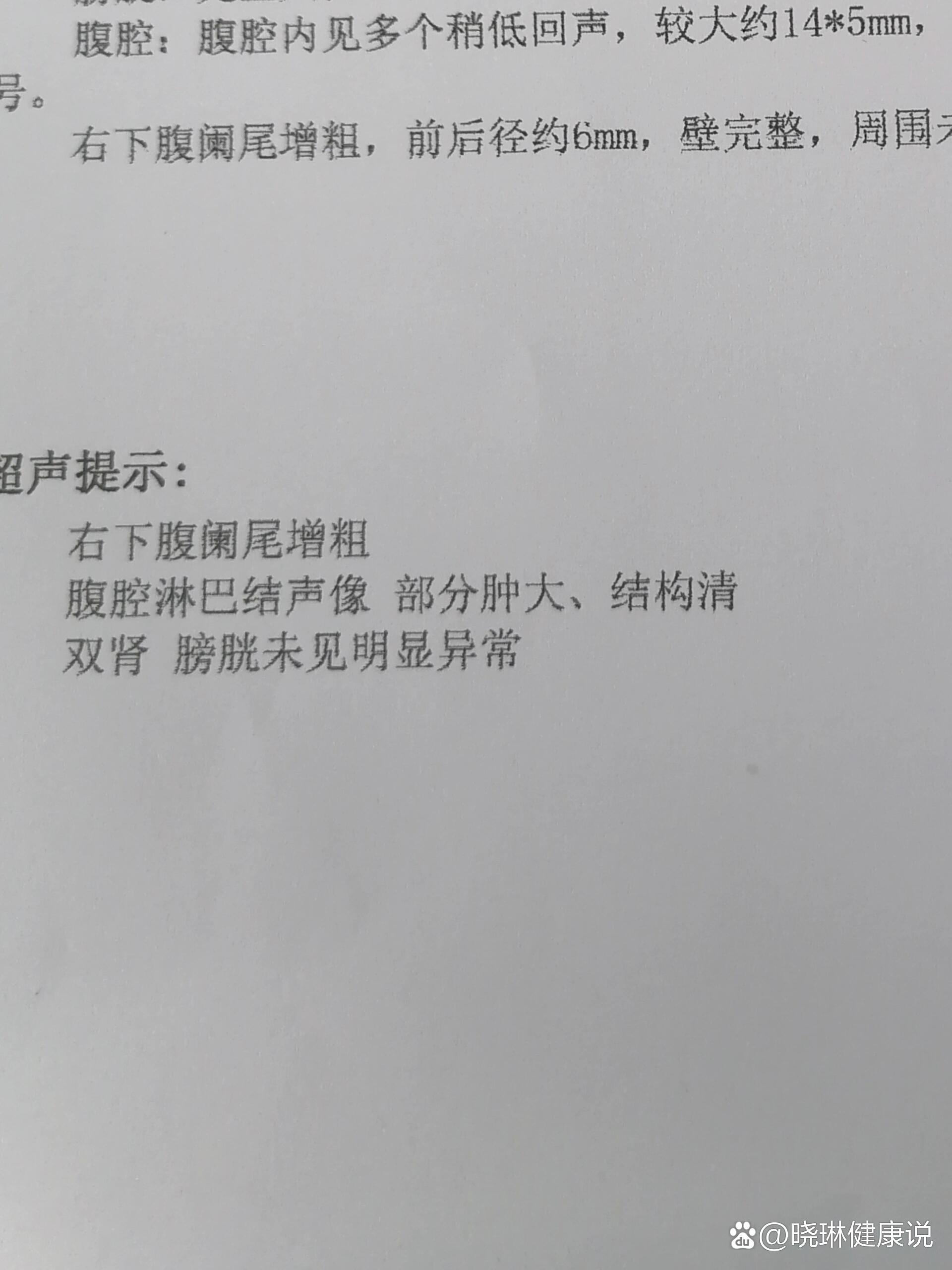 阑尾炎CT报告图片