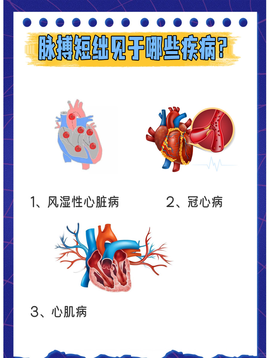 绌脉图片