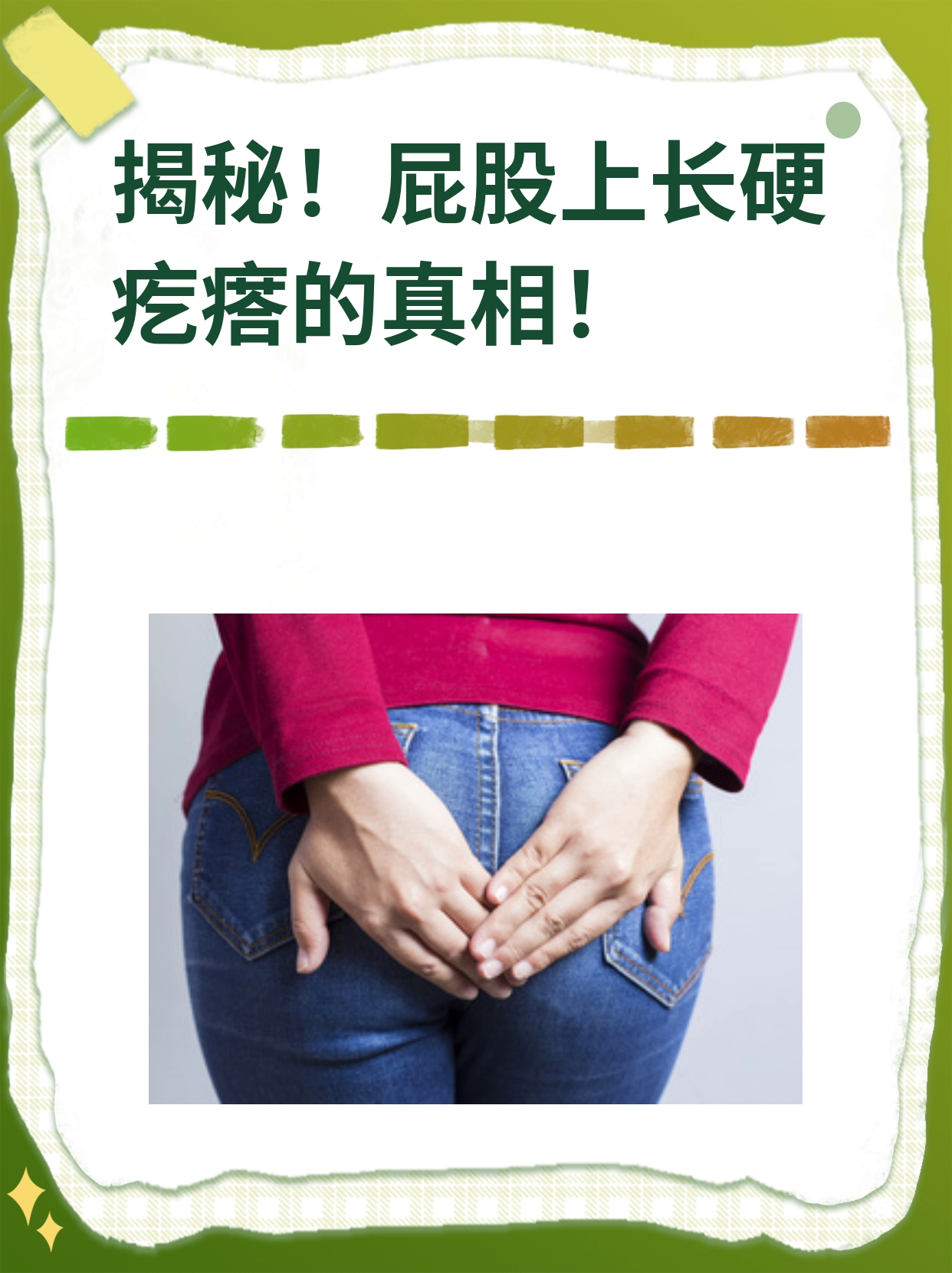揭秘!屁股上长硬疙瘩的真相