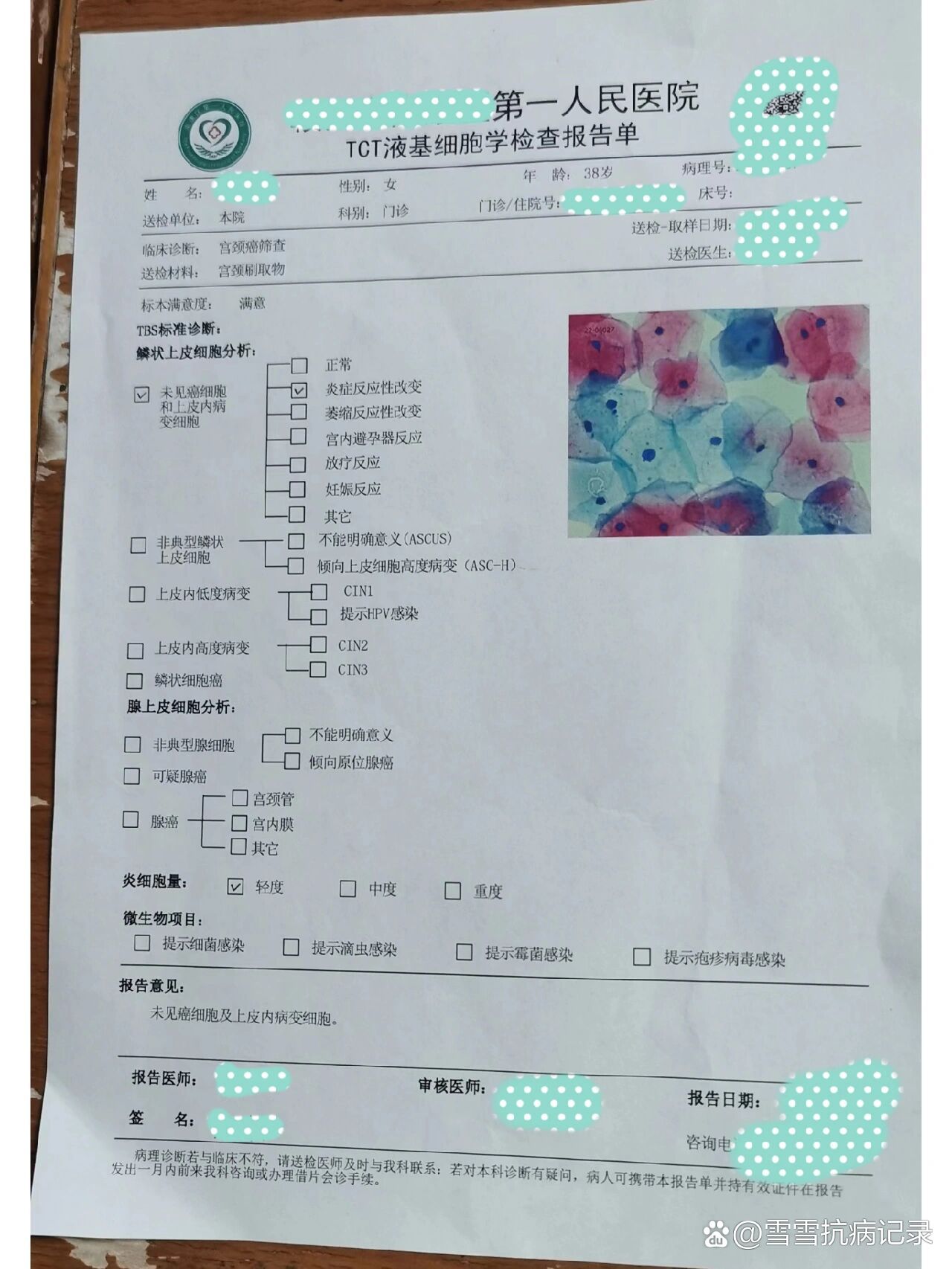 tct炎性反应改变是啥情况