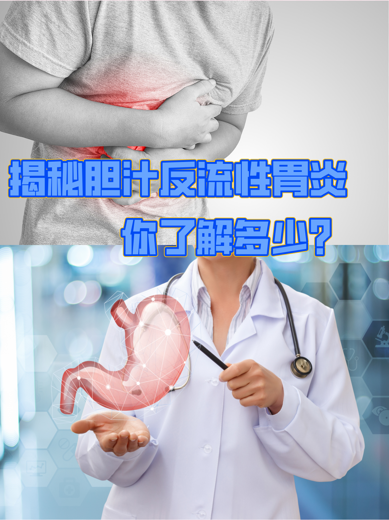 胆汁反流性胃炎:胃里的"绿色警报"