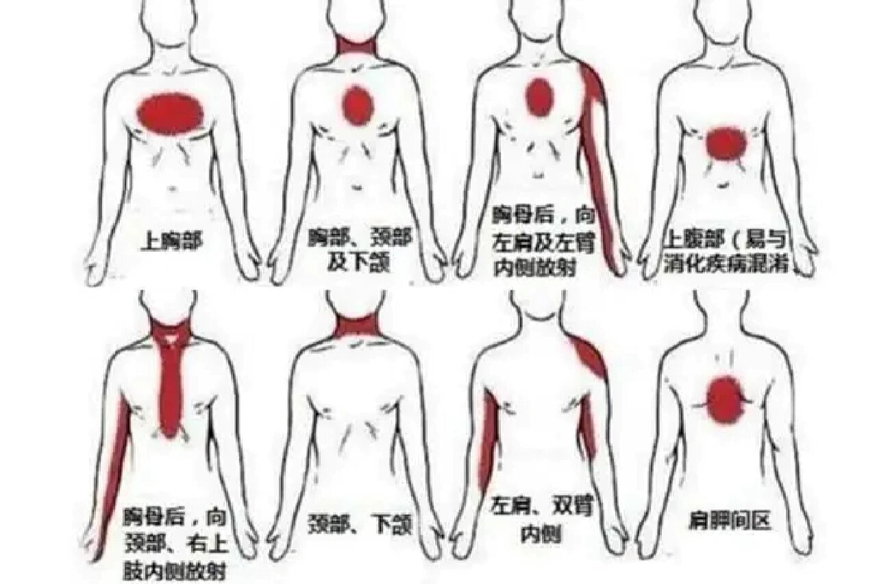 背部痛点对应图图片