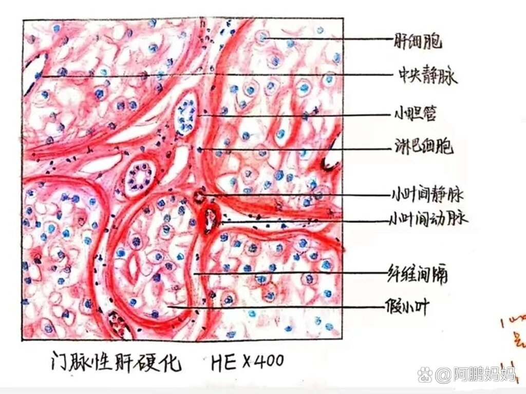 槟榔肝切片绘图图片