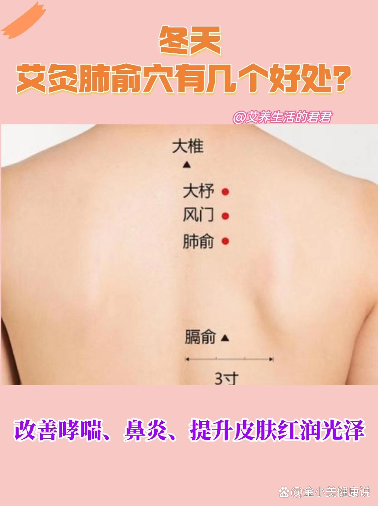 冬季艾灸肺俞穴改善哮喘,鼻炎,皮肤红润光泽