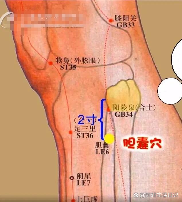 缓解胆囊炎发作的小方法