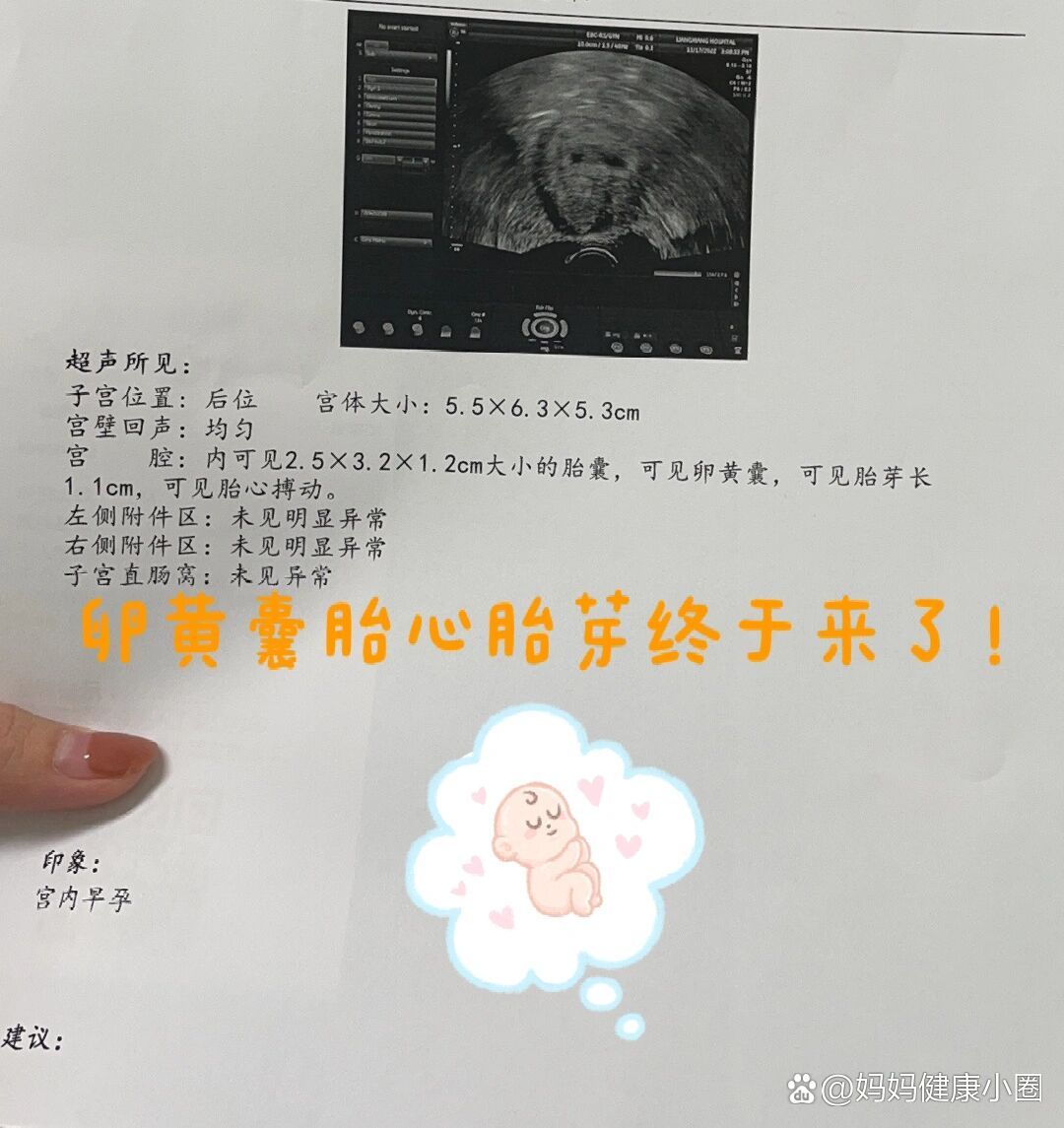 迟到的卵黄囊胎心胎芽终于来了!