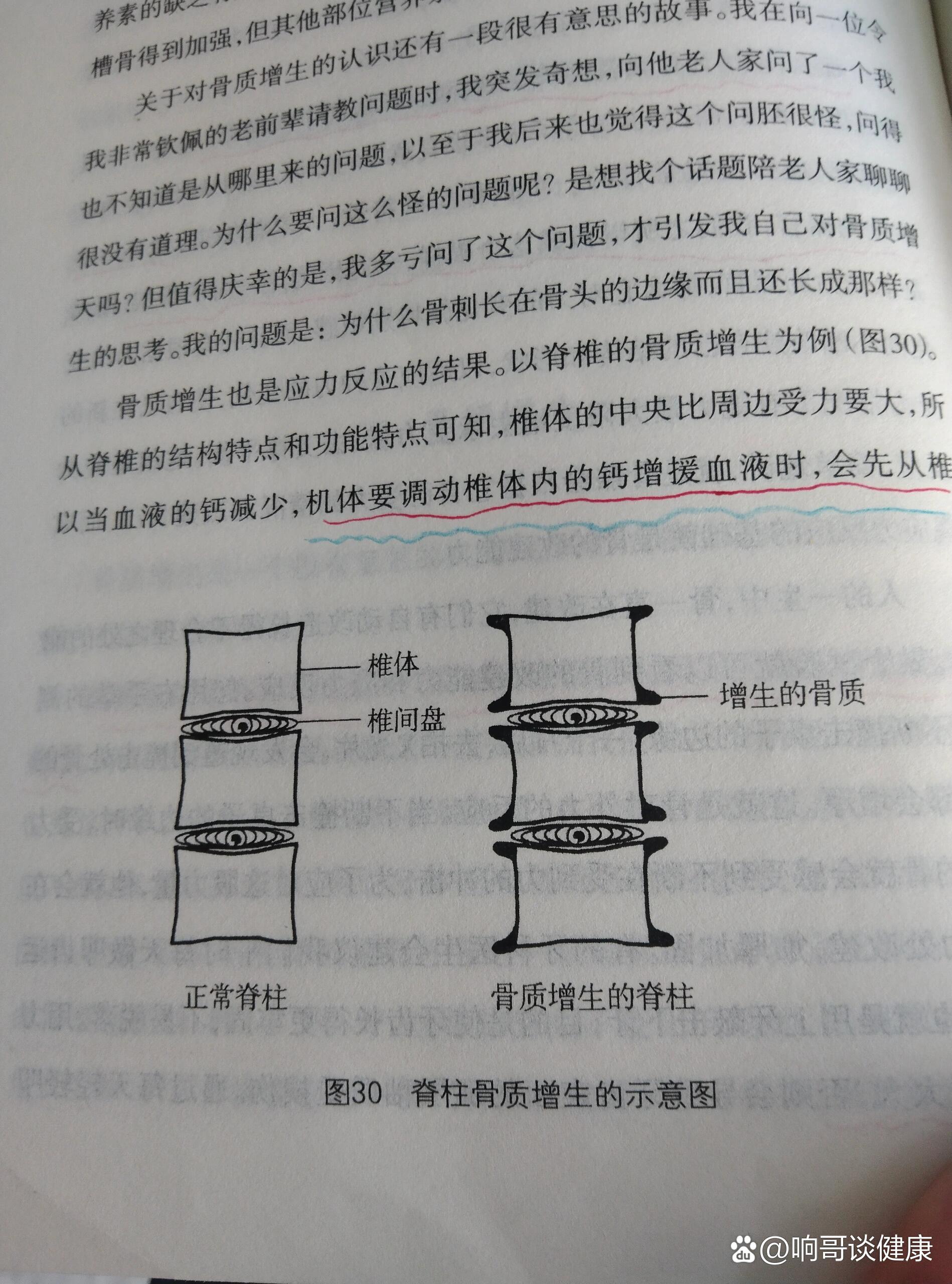 钩椎关节示意图图片