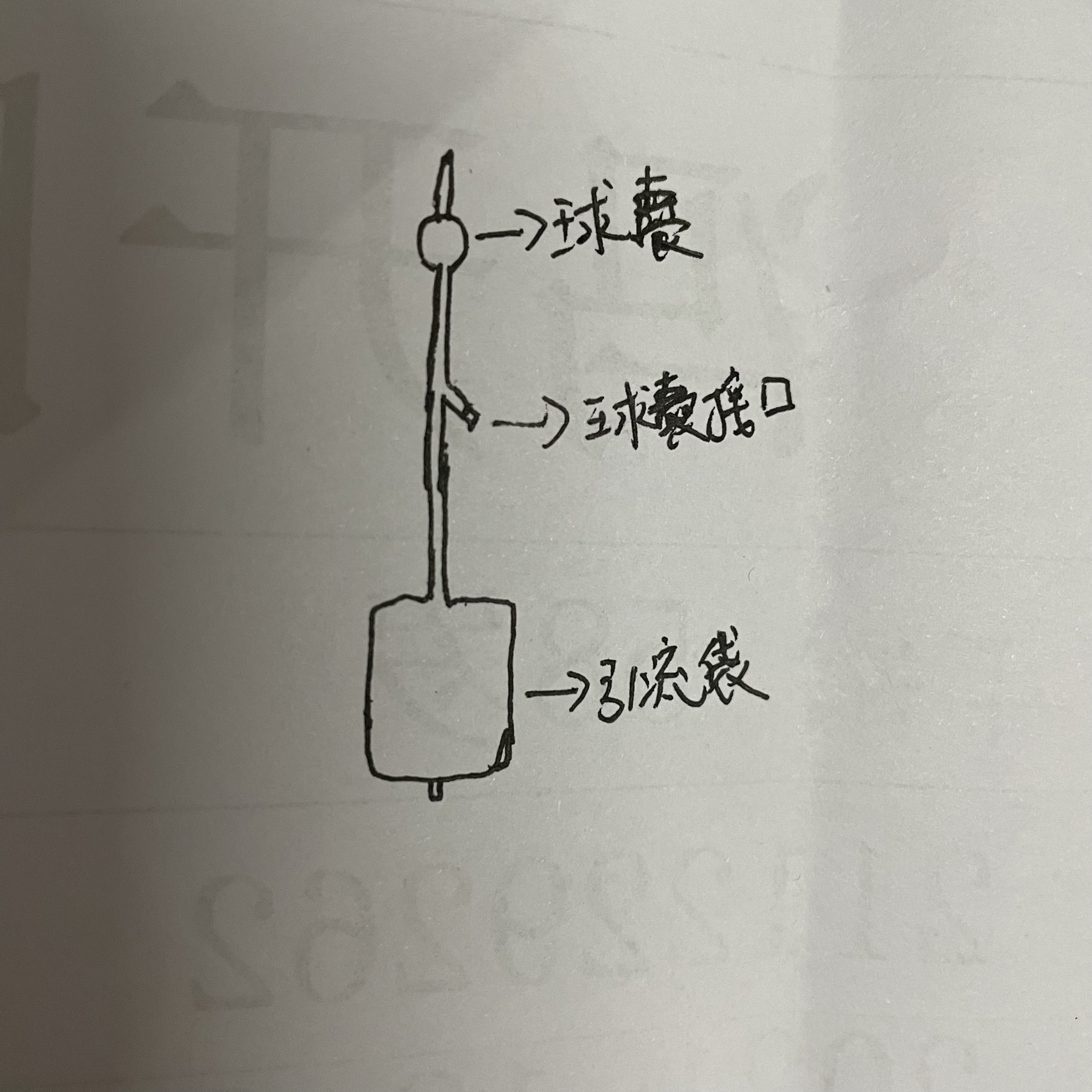 今天把宫腔粘连放置的球囊自己取出来了