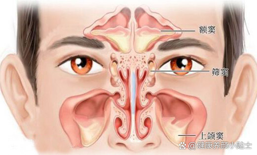 右侧上颌窦囊肿图片图片
