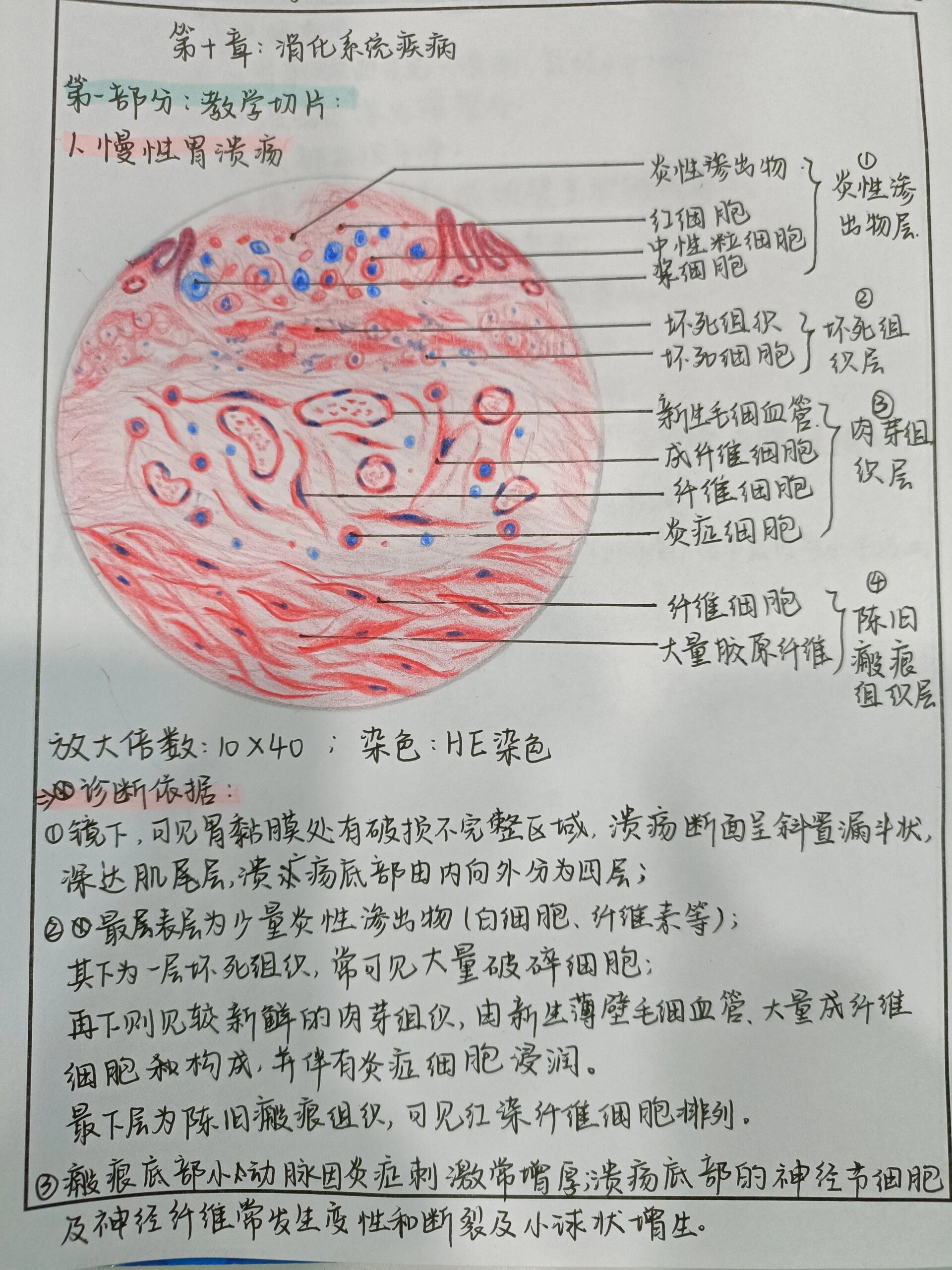 鼻息肉实验报告手绘图图片