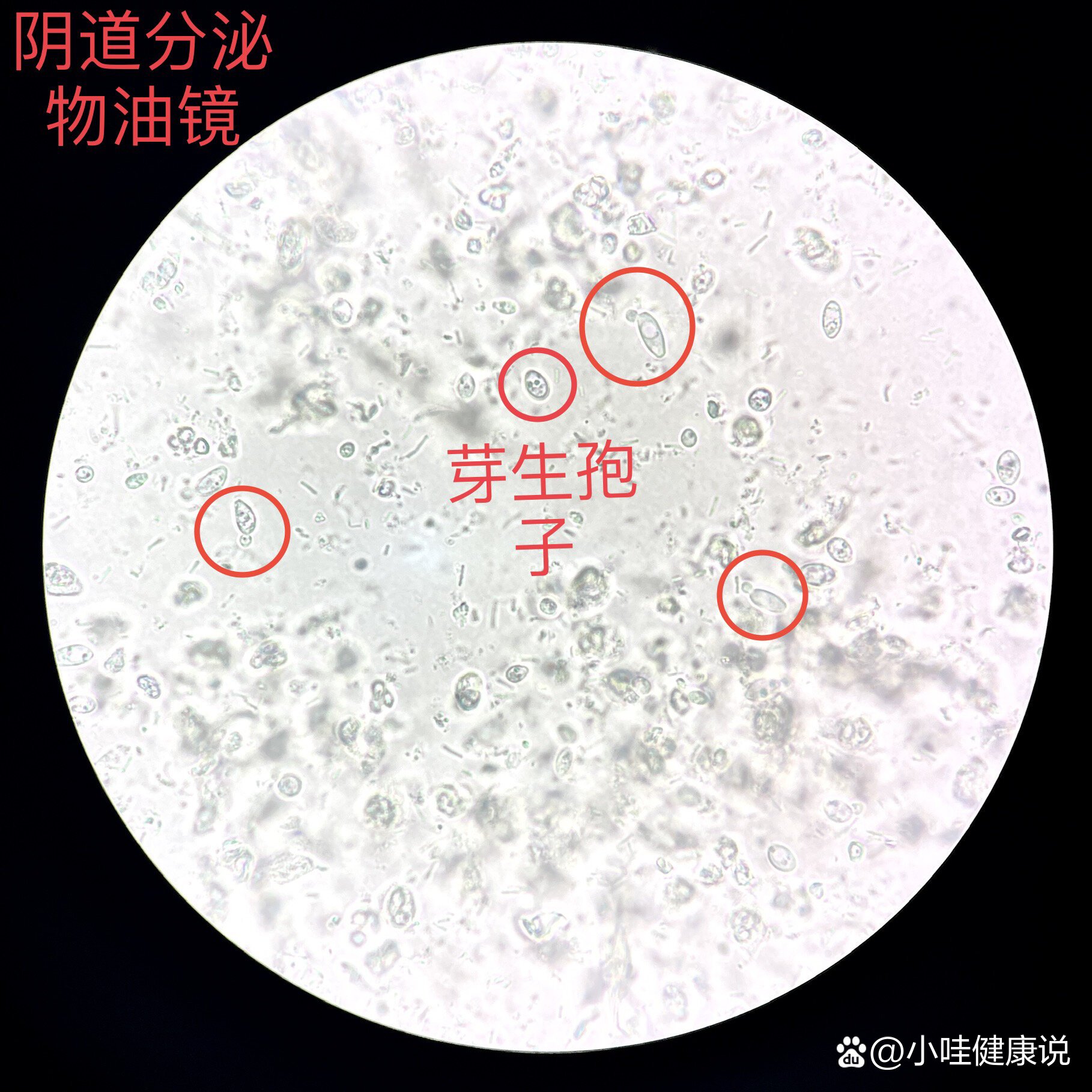 白带常规镜检图片教学图片