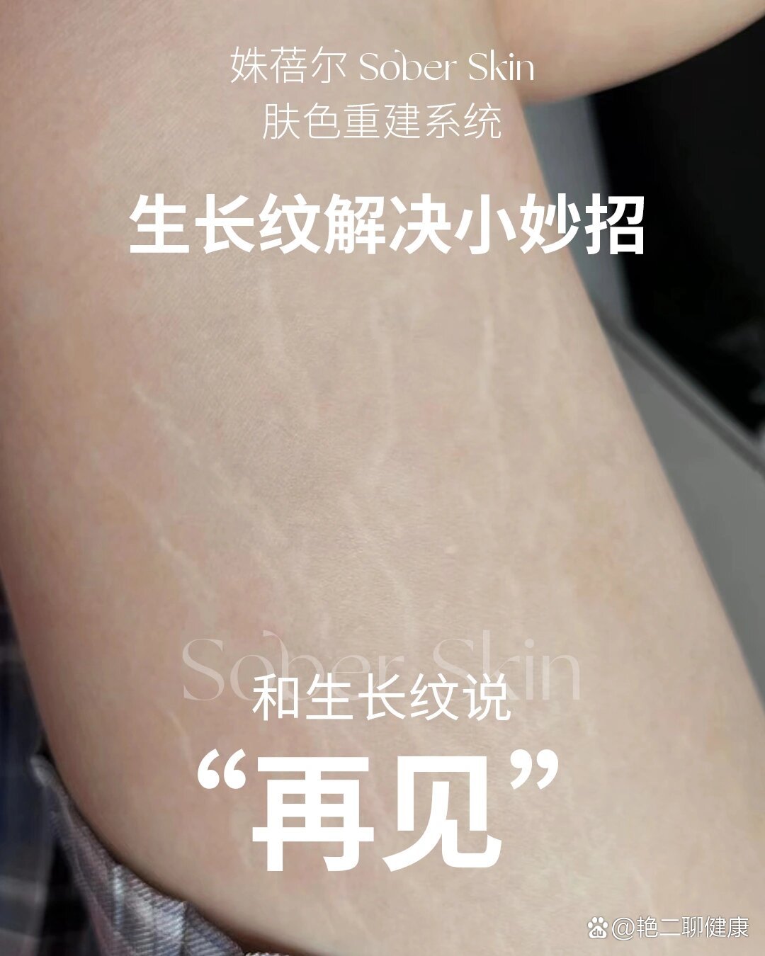 生长纹解决小妙招,和生长纹说"再见"