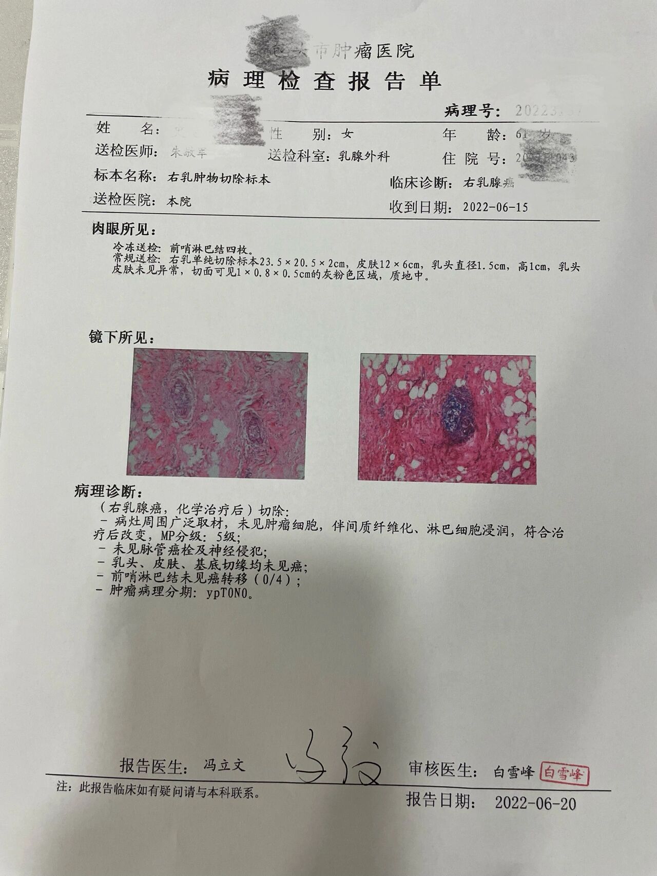 肿瘤活检报告图片