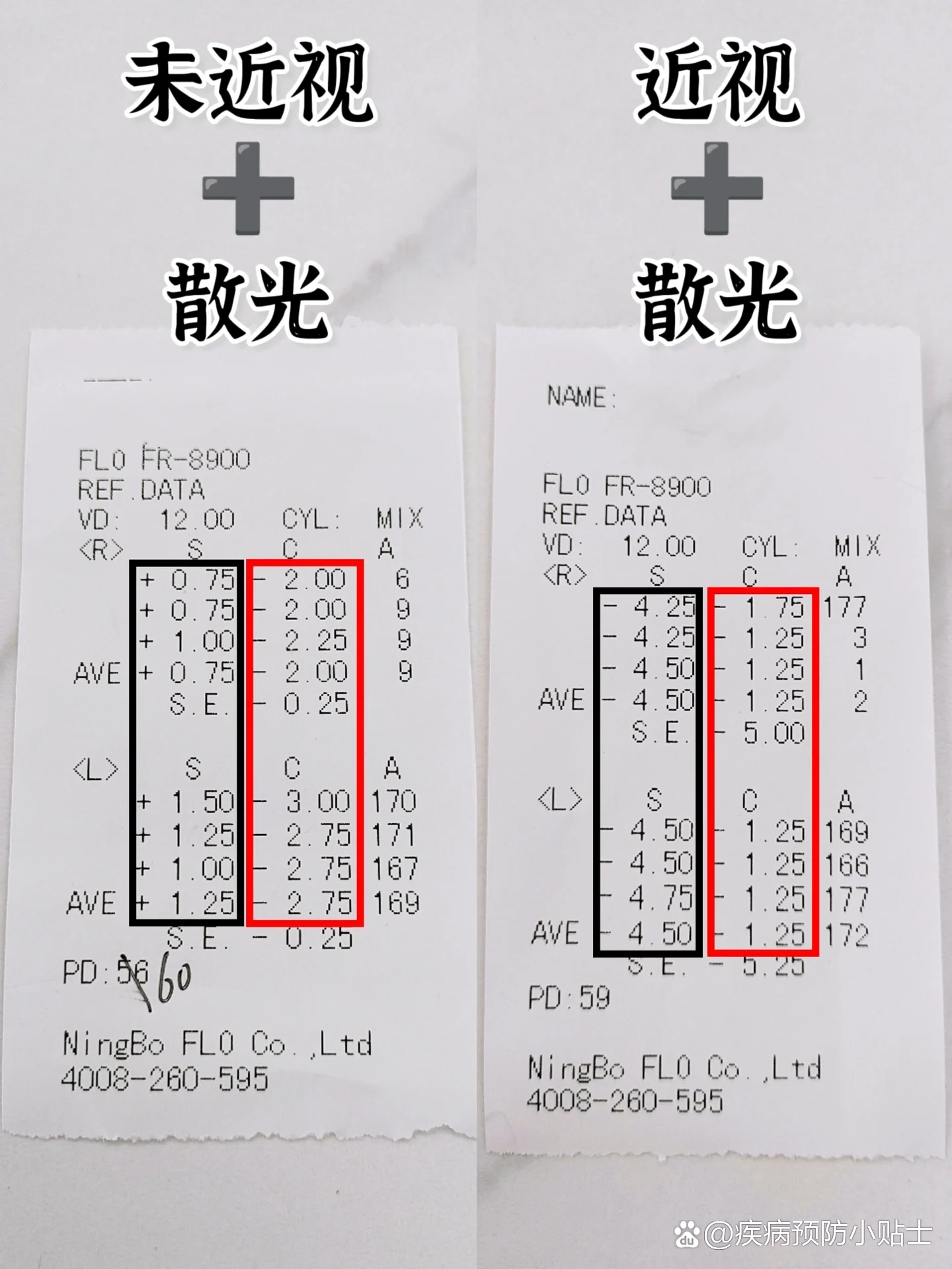 散光100度严重吗图片