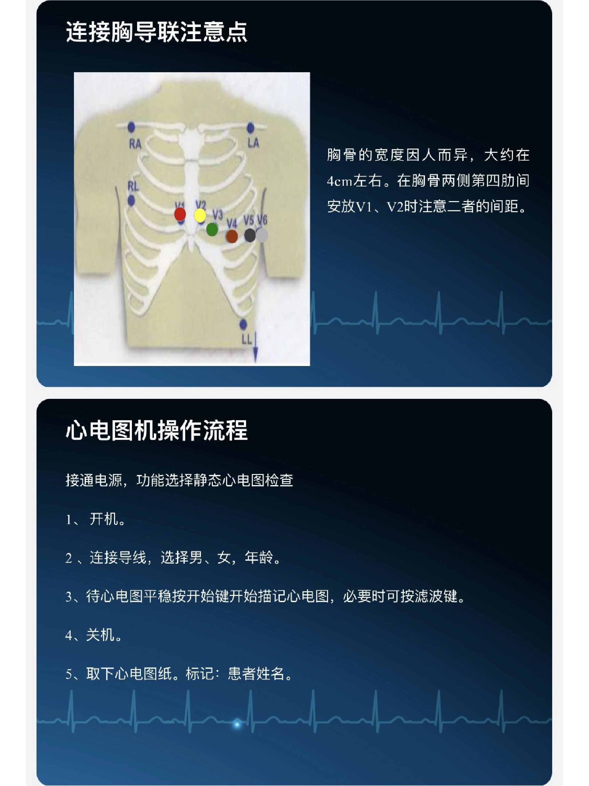 心电图机的使用及图解图片