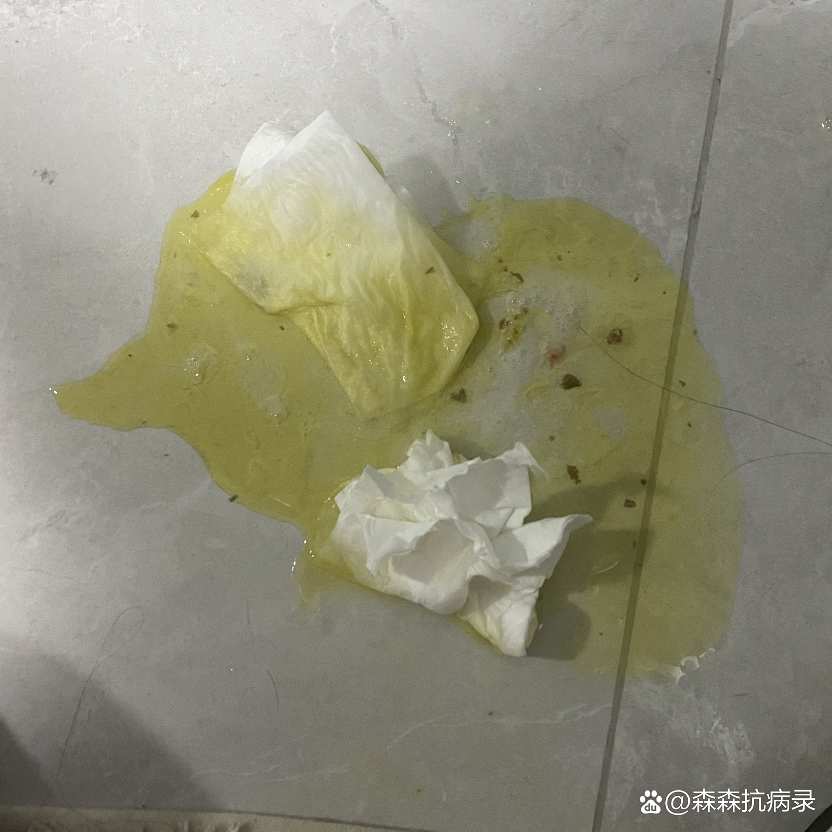 黄连素 呕吐图片