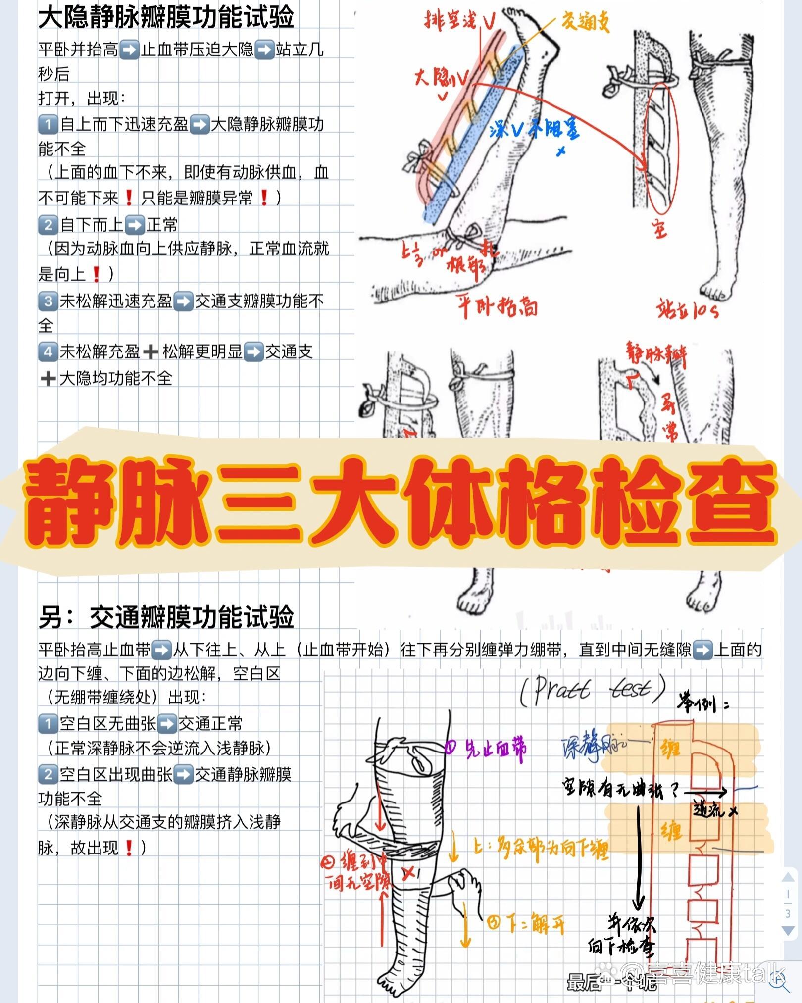 大隐静脉体表标志图片