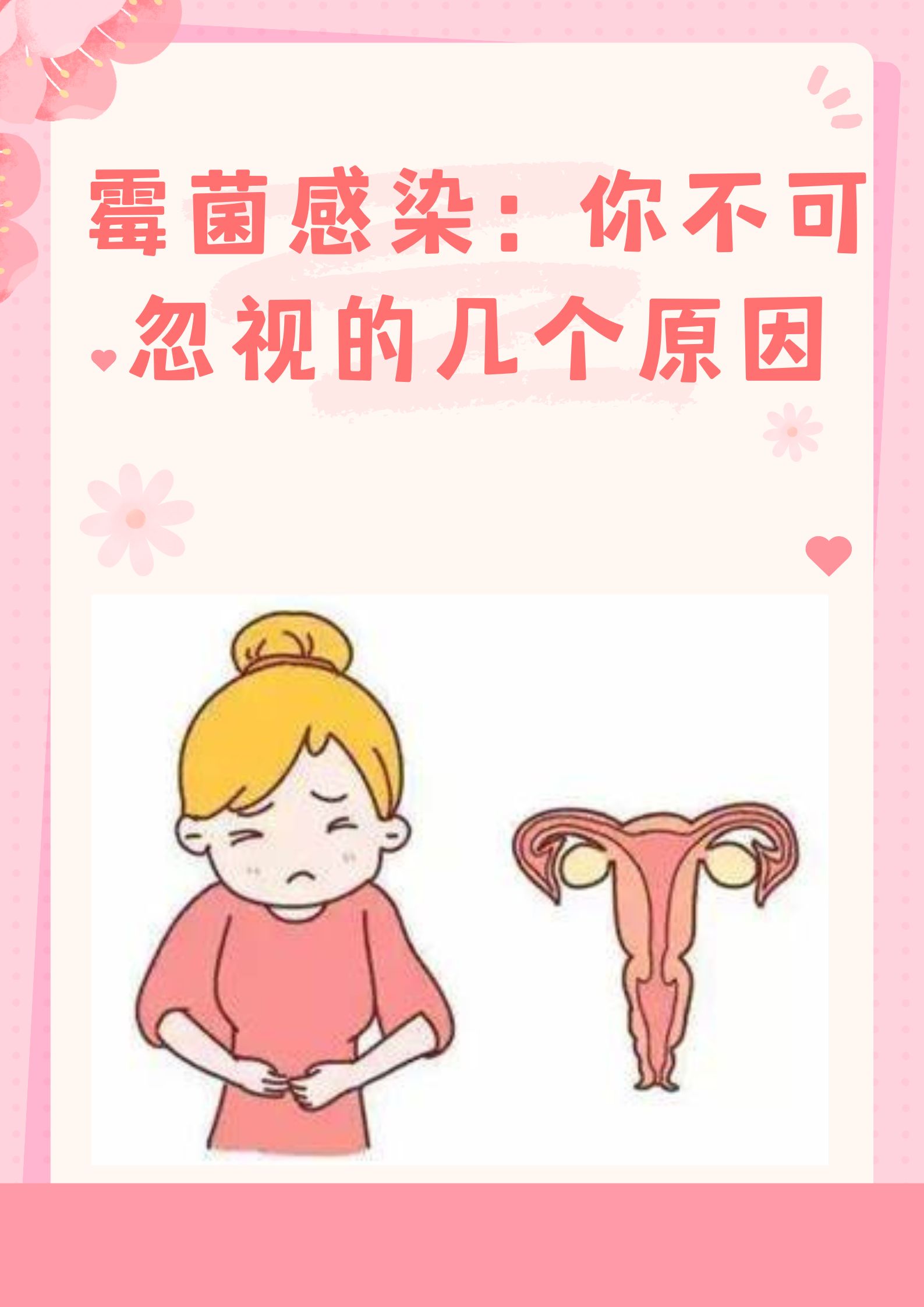 孕妇霉菌症状图片图片