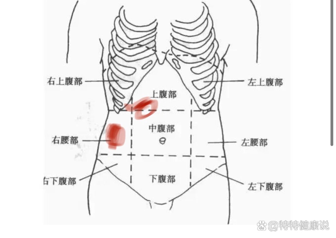 第二肋间的位置图片图片