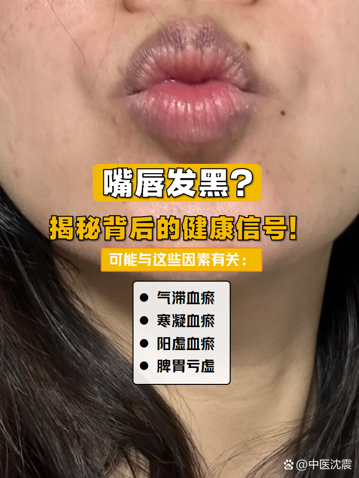 嘴唇发黑？
