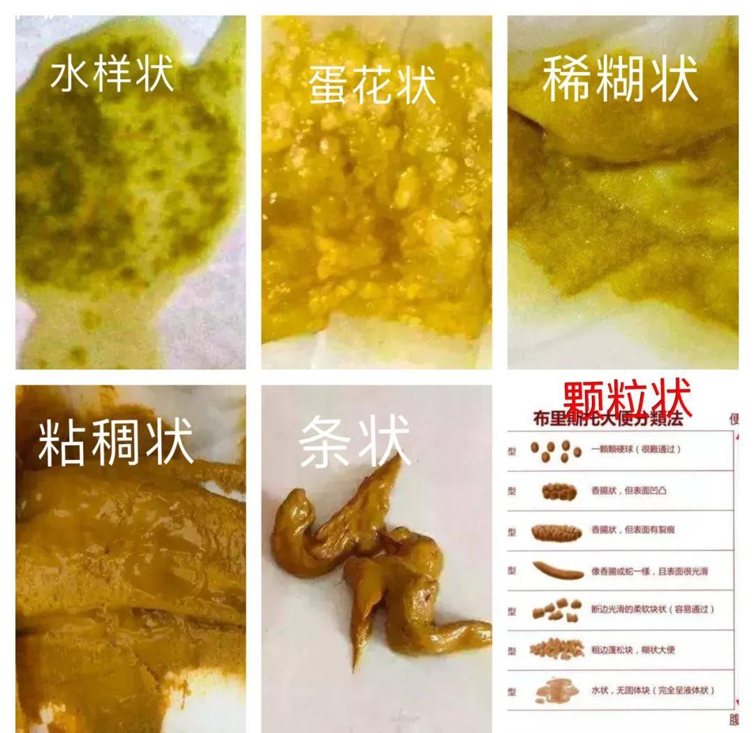 宝宝便便那些事儿，新手爸妈必看！