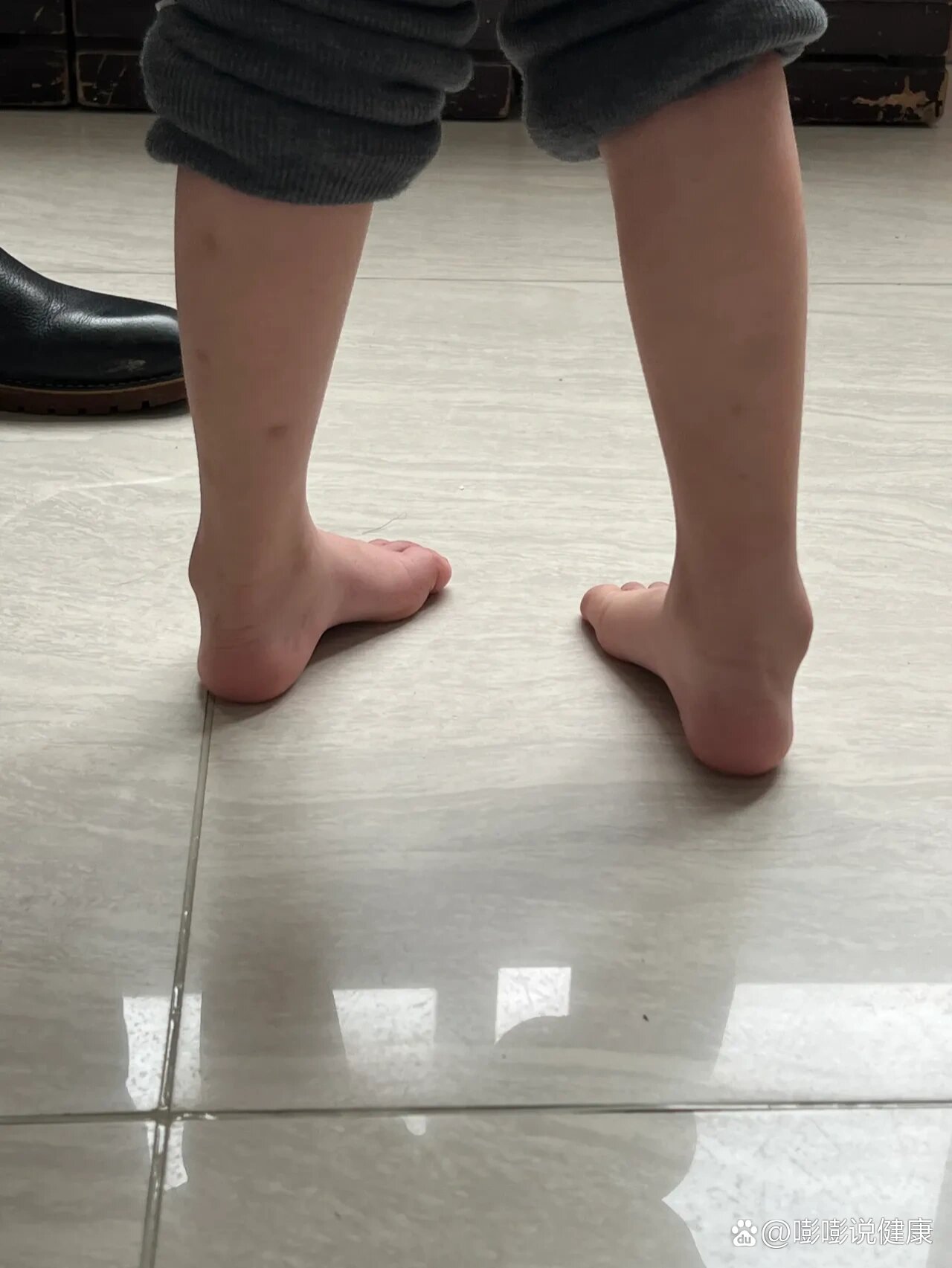 3岁的孩子足弓就那么高,难怪不会走路.