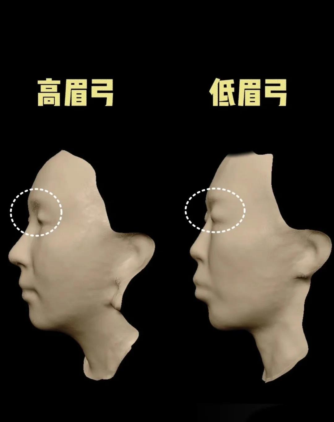 眉弓高低影响颜值？