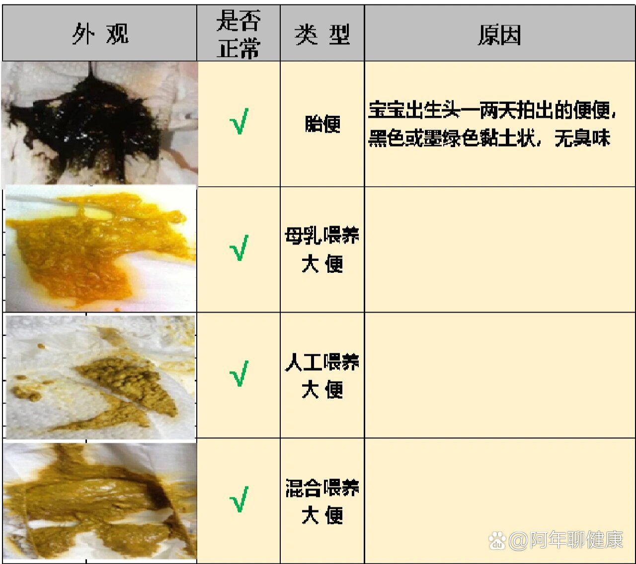 宝宝大便类型全解(一)