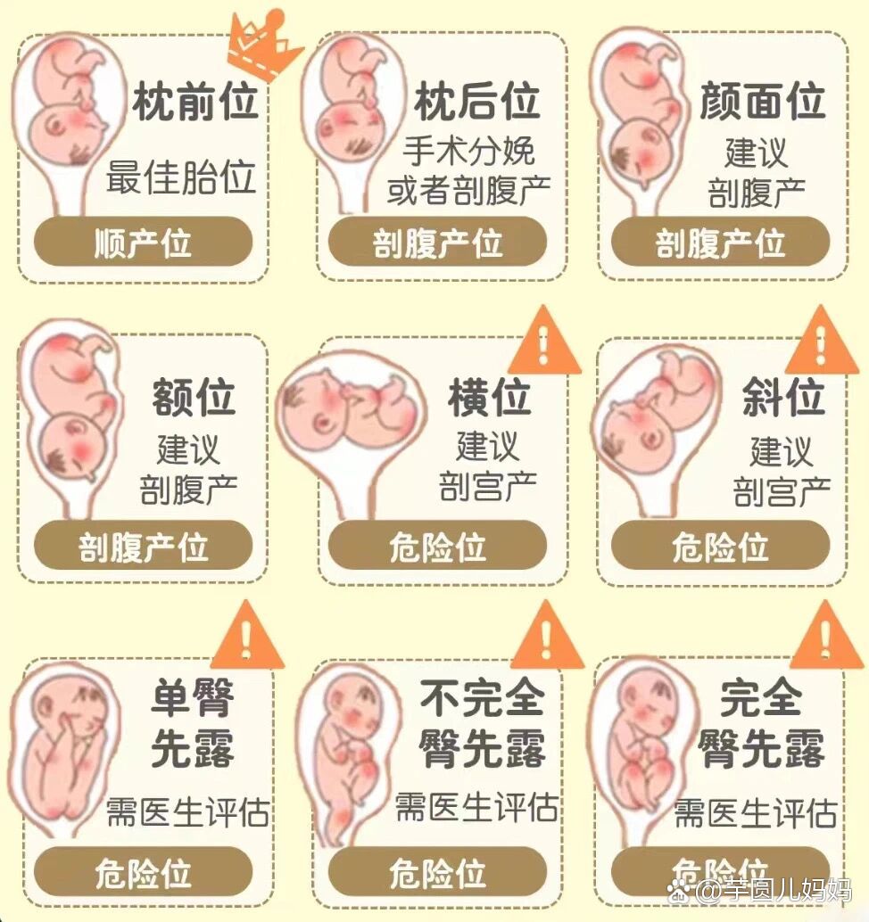 胎位不正的10大原因