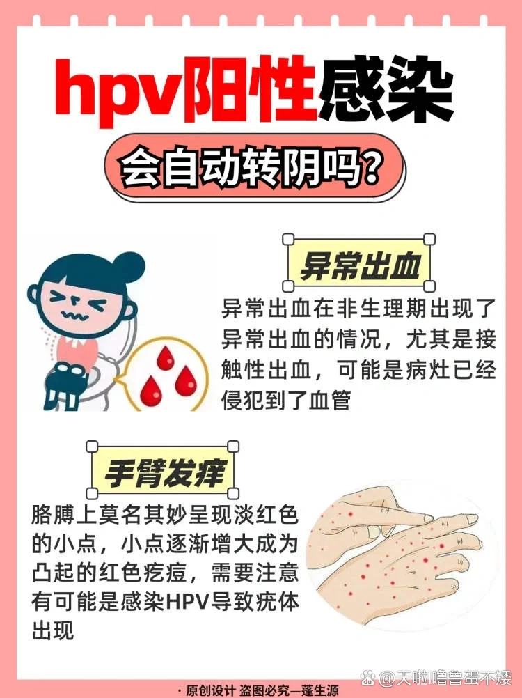 hpv阳性,会自动转阴么?