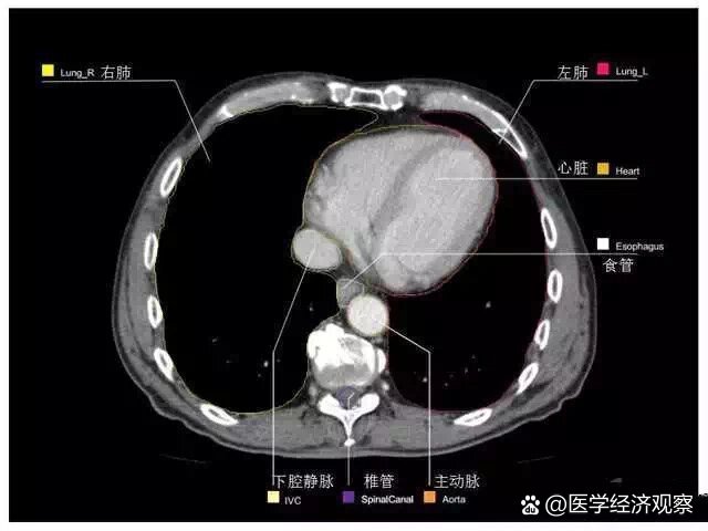 全腹部ct影像高清实用图谱11566