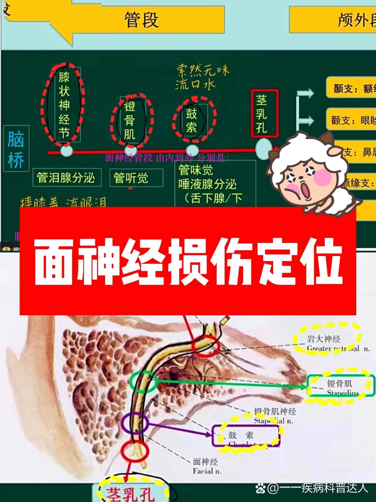 面神经阻滞定位图片图片