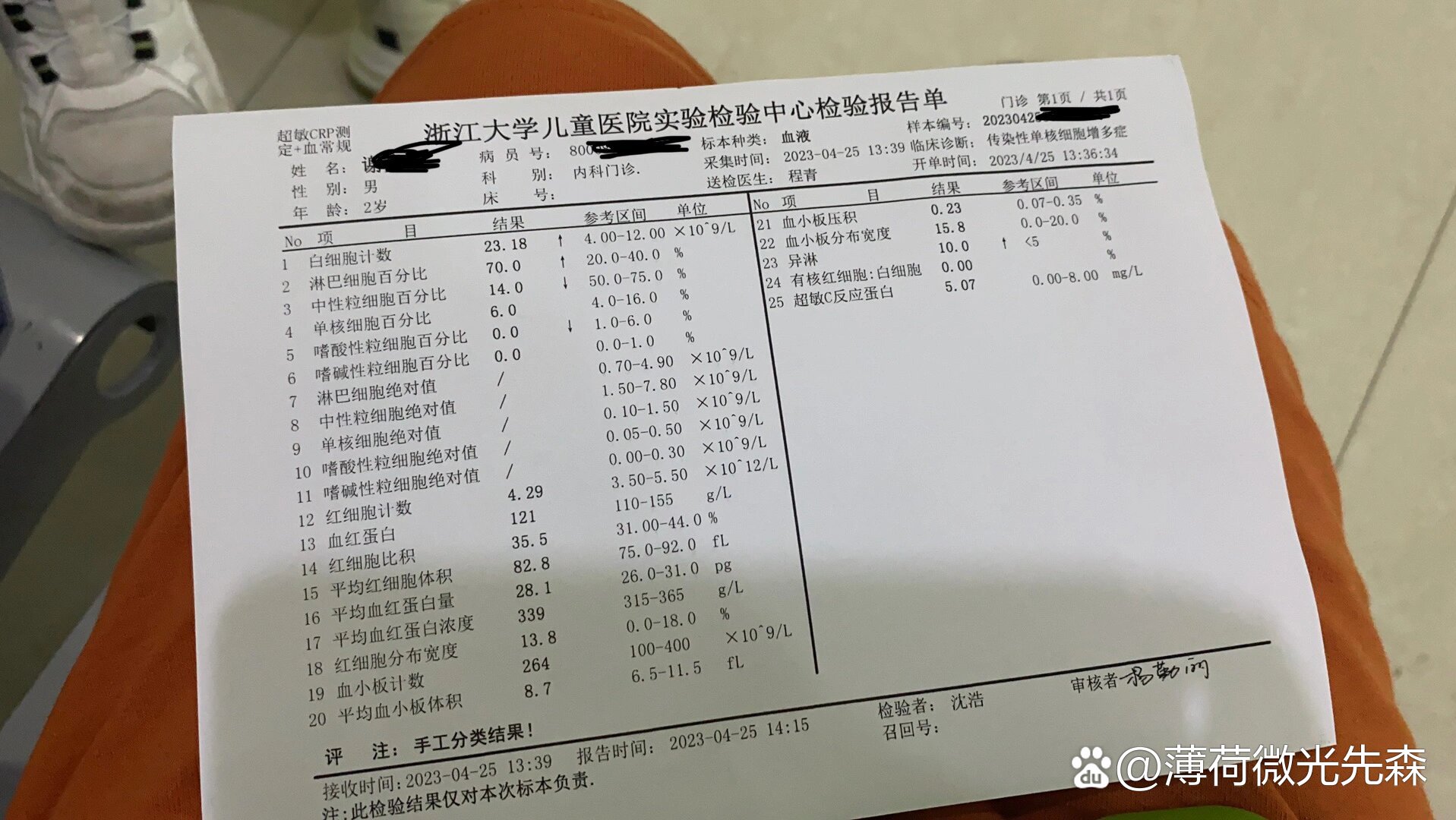 eb病毒(传染性单核细胞增多症)