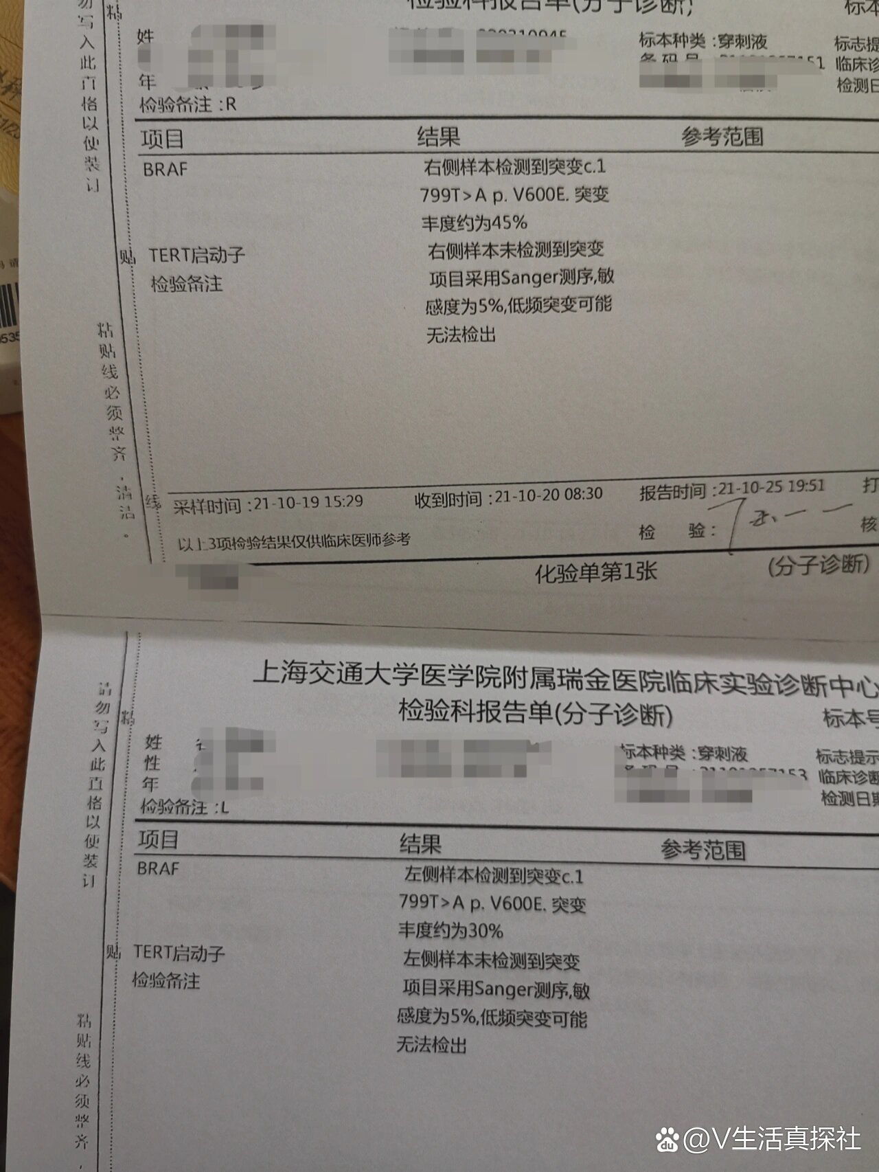 求大神解读一下甲状腺大病理报告