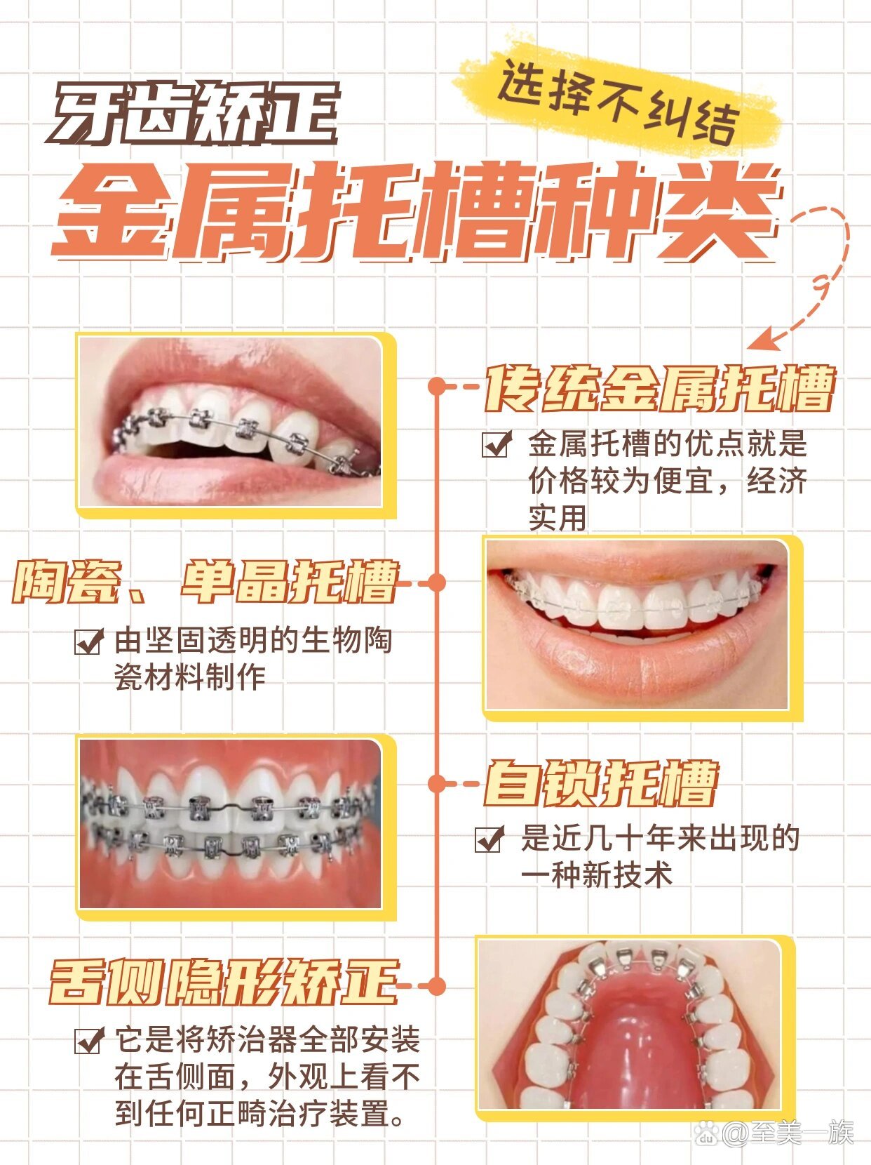 美国ormco自锁托槽介绍图片