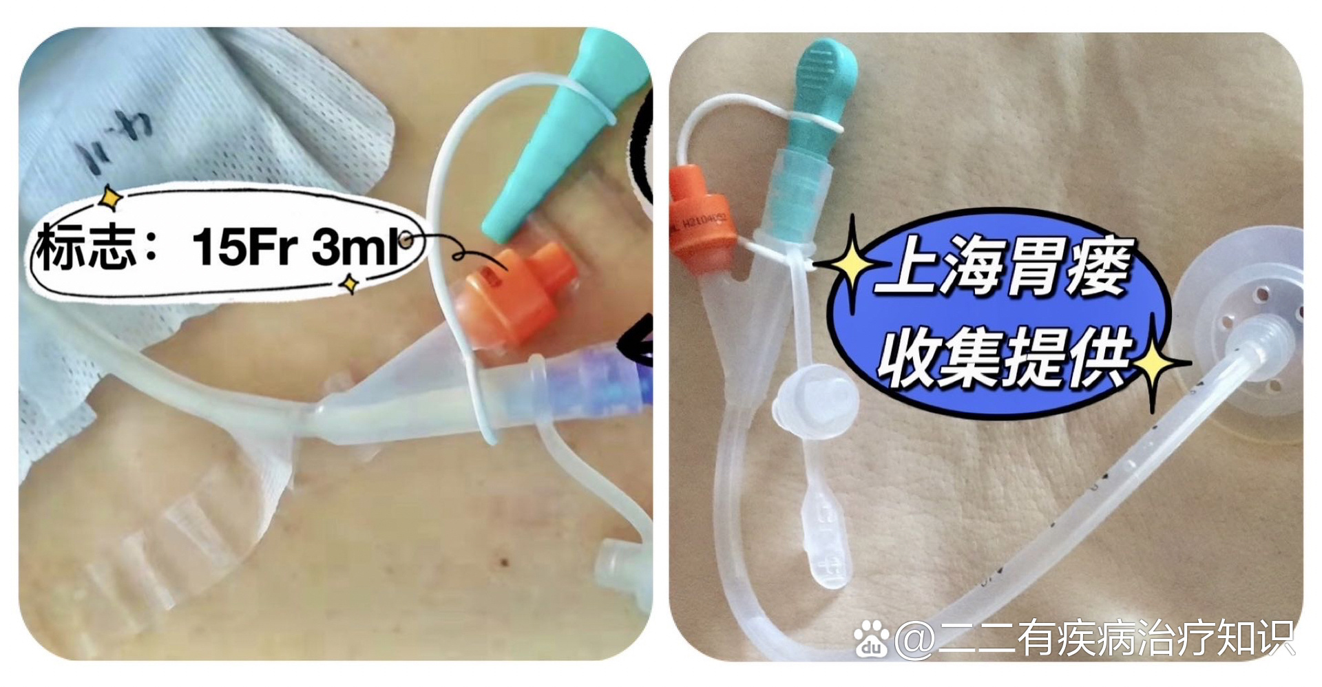 造瘘标识,造瘘_大山谷图库