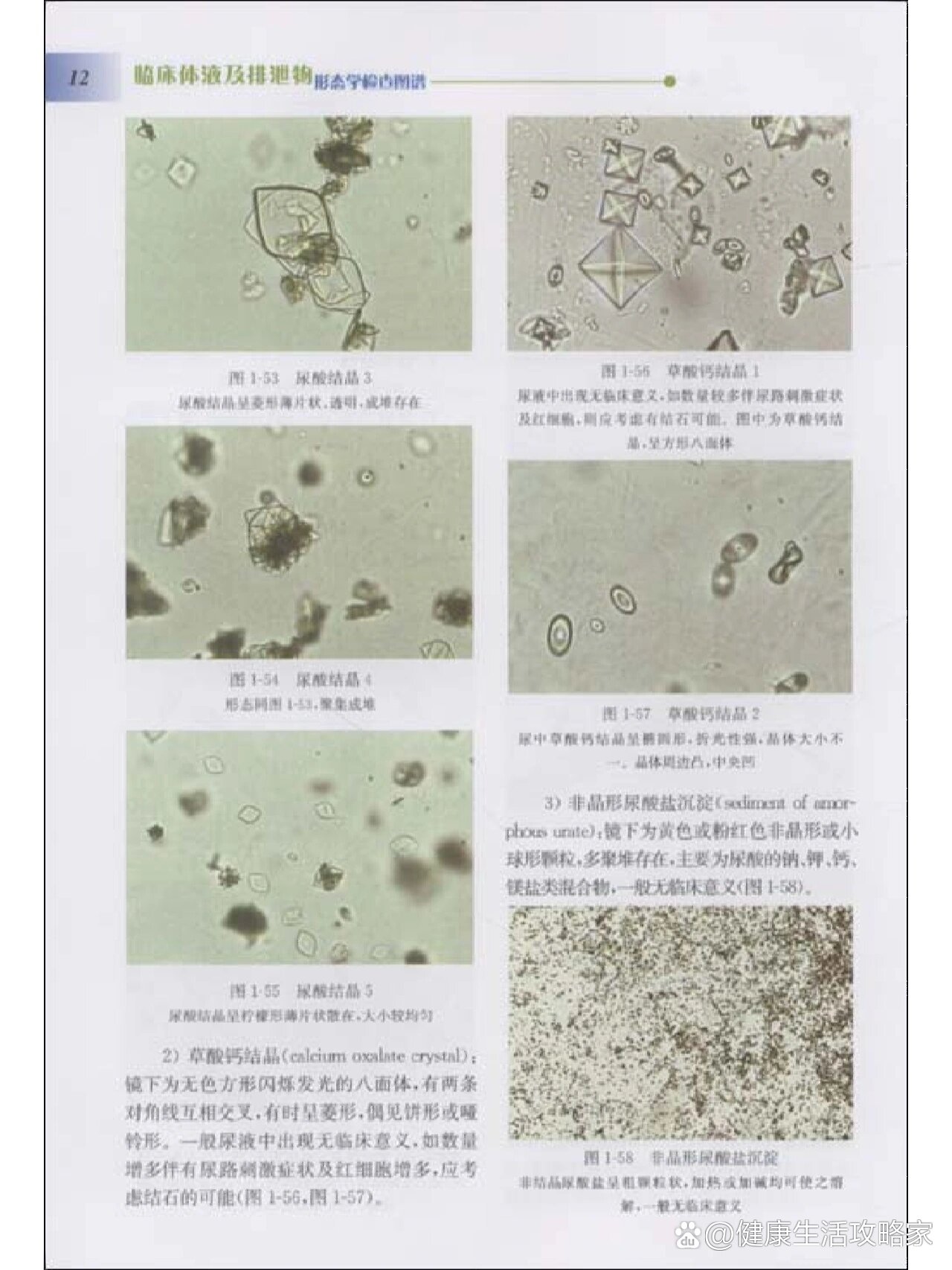 草酸钙结晶图图片