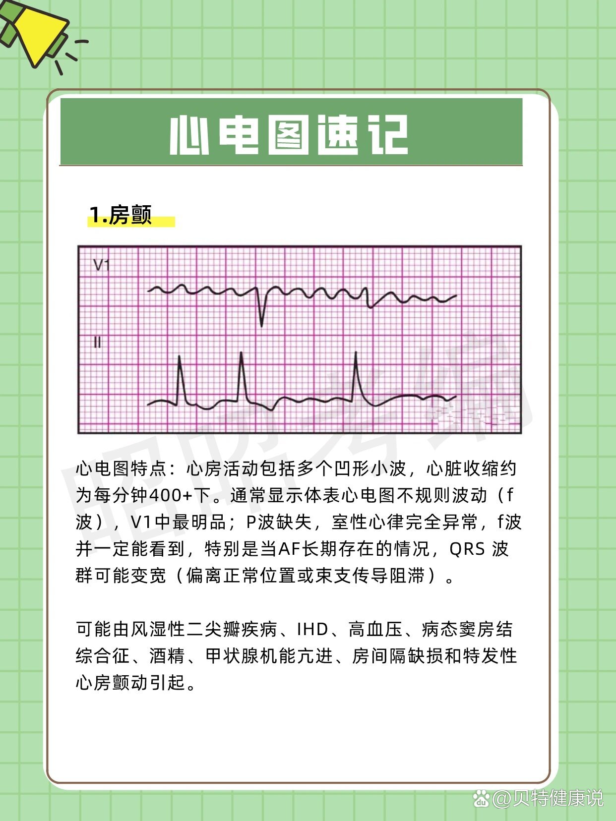 脑电图异常波解读图片