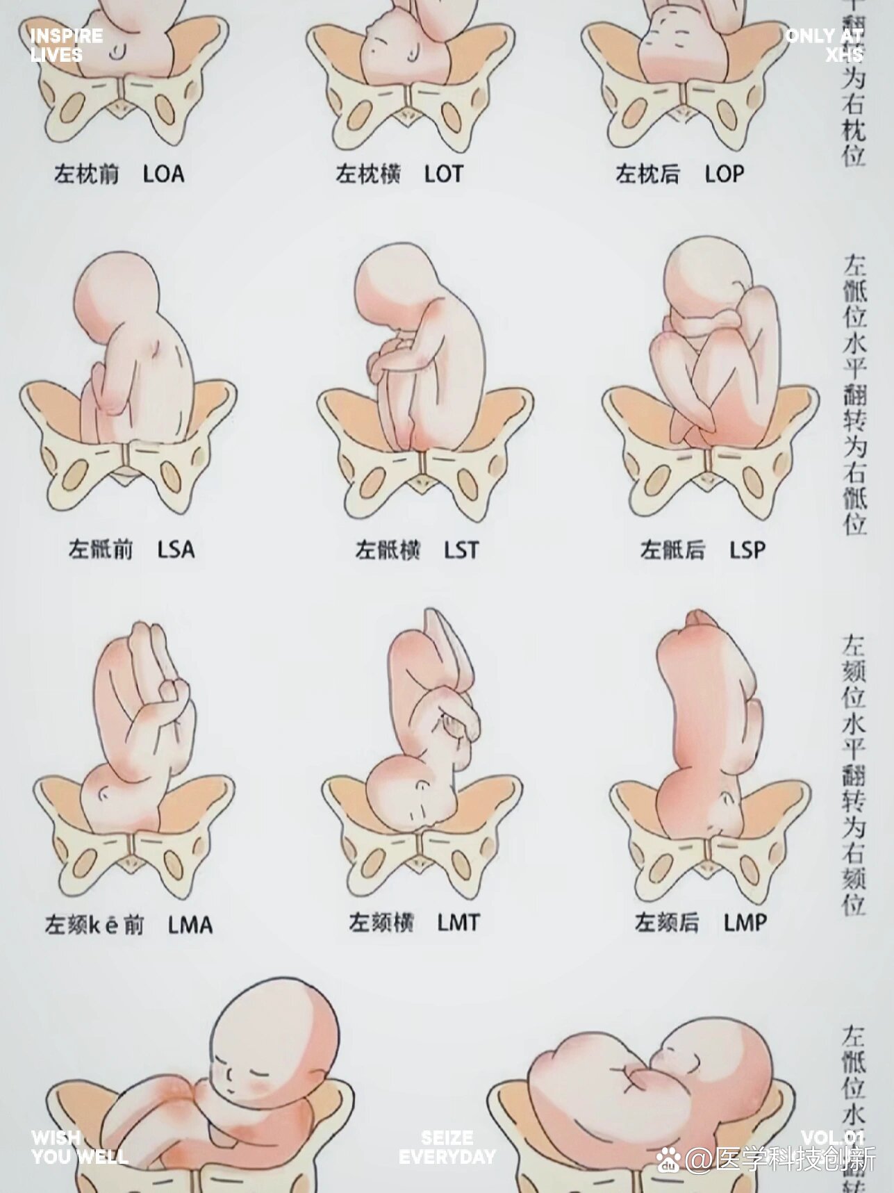 胎儿入盆