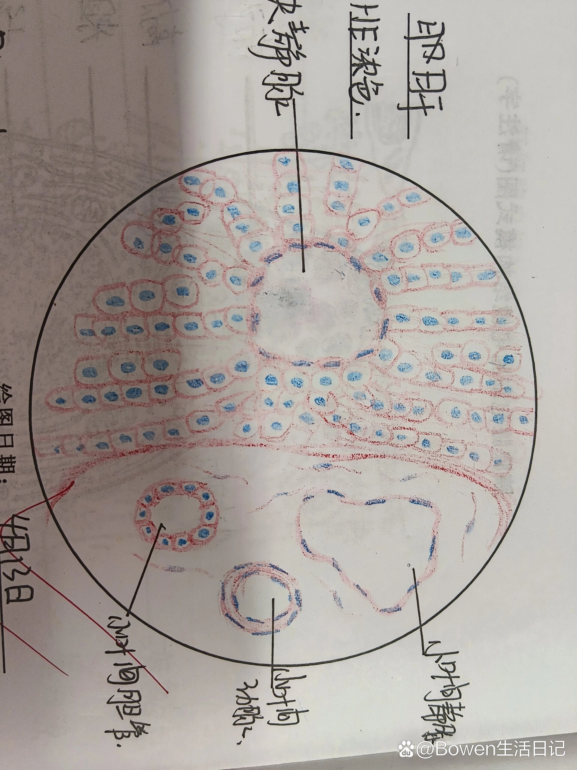 肝硬化假小叶手绘图图片