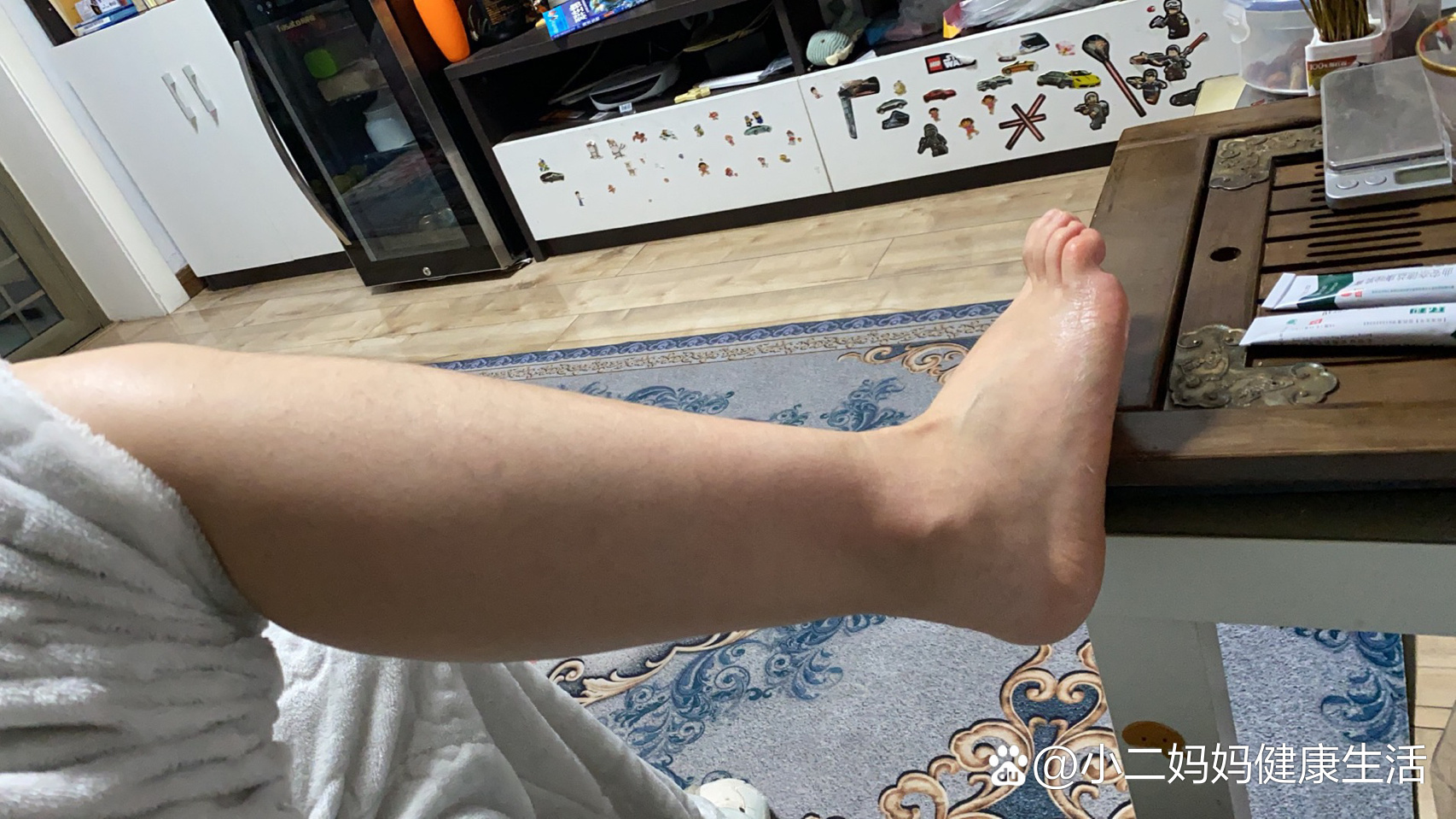 腿肿的莫名其妙1～横纹肌溶解症