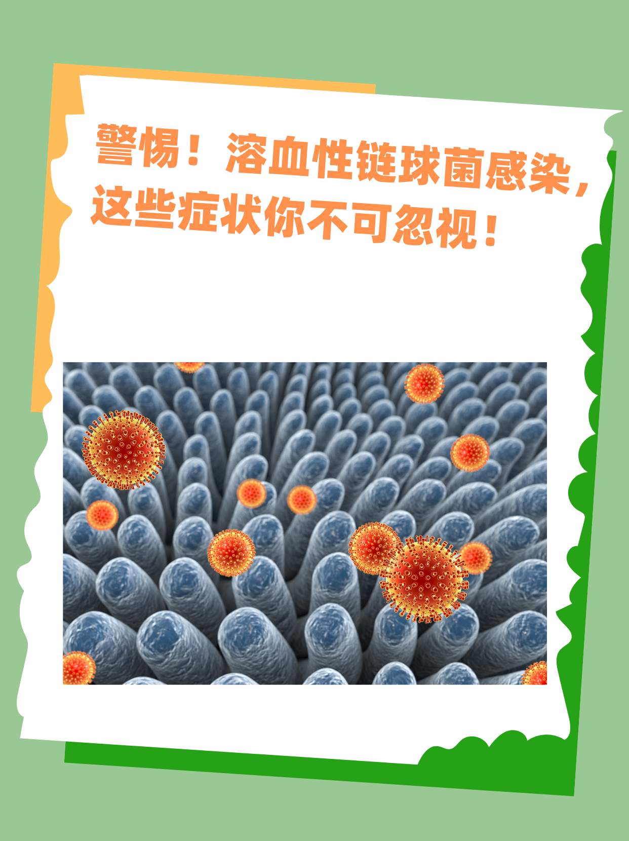 警惕!溶血性链球菌感染,这些症状你不可忽视!