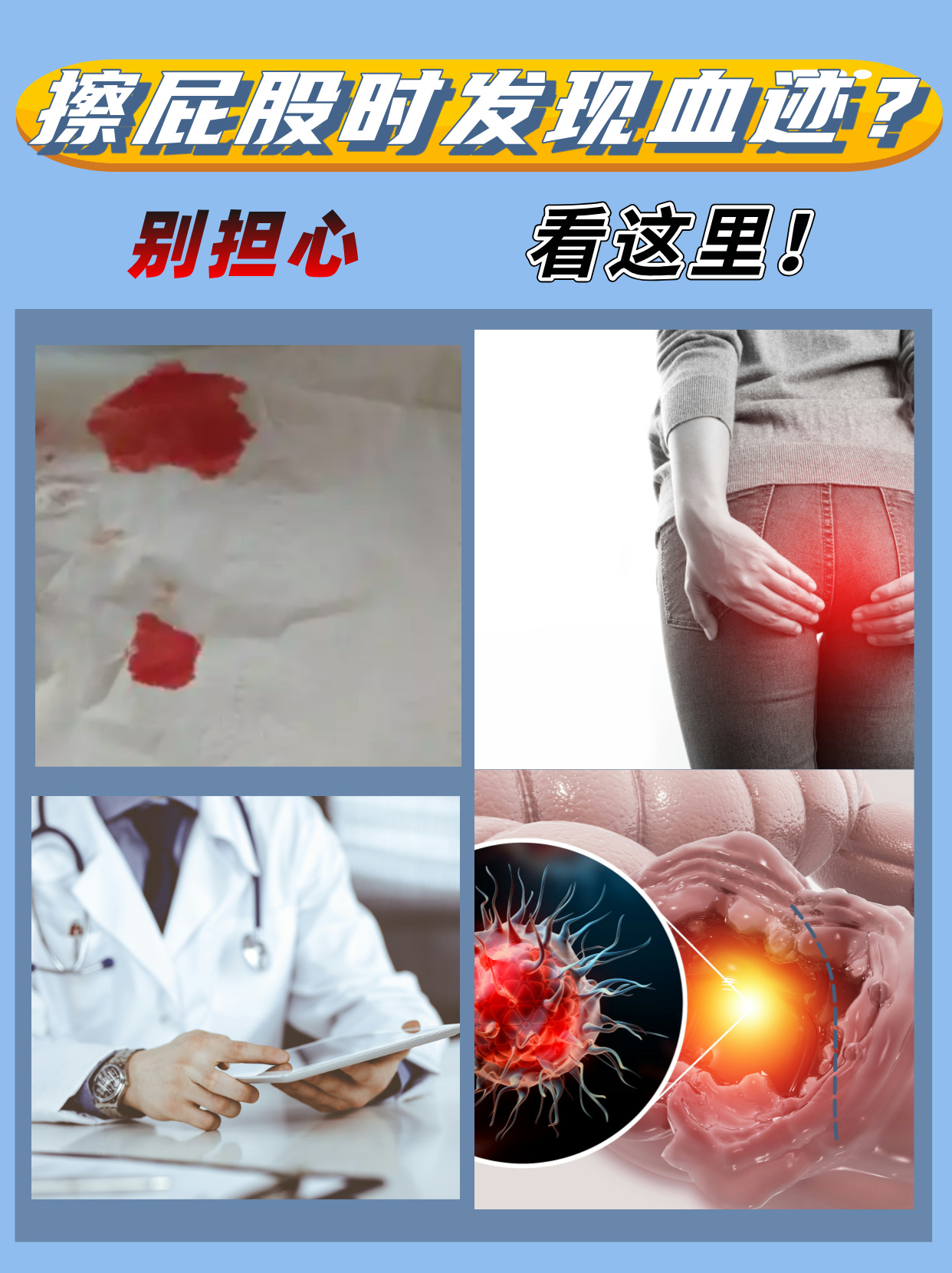 拉屎为什么擦屁股有血