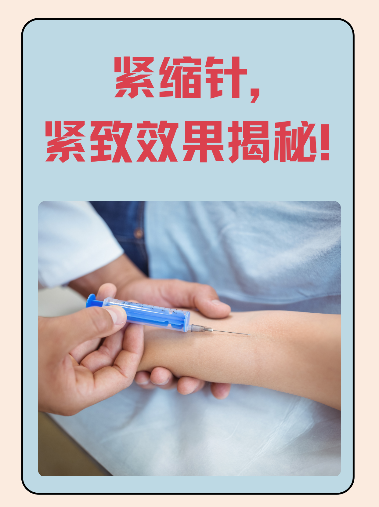 紧缩针,紧致效果揭秘!