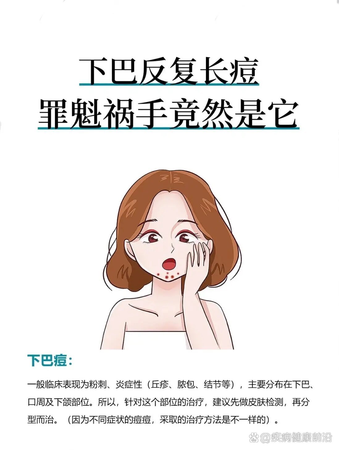 下巴长痘痘图片 卡通图片